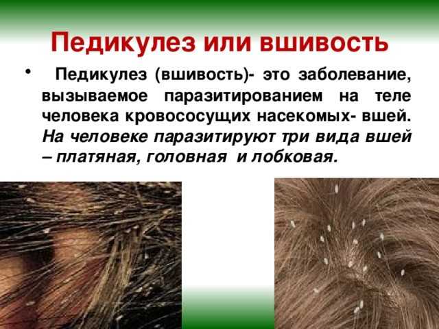 Вши у детей: основные причины появления