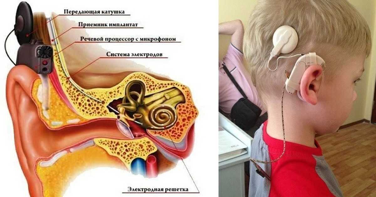 Ребёнок стал плохо слышать на одно ухо