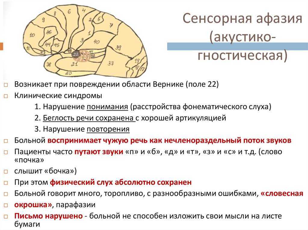 Синдром моторной афазии брока при инсульте: признаки, симптомы, лечение | ким