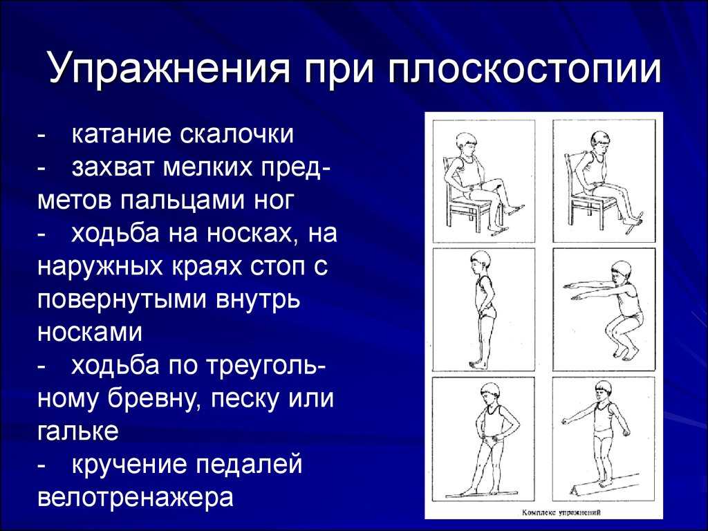 Упражнения при плоскостопии у детей 6-10 лет: подробно в картинках