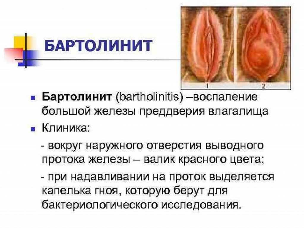 Большие половые губы — проблема ли это и стоит ли уменьшать
