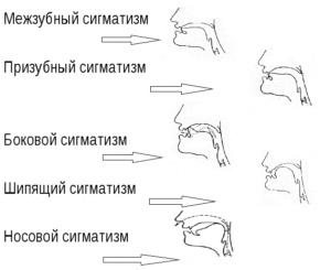 Согласные звуки