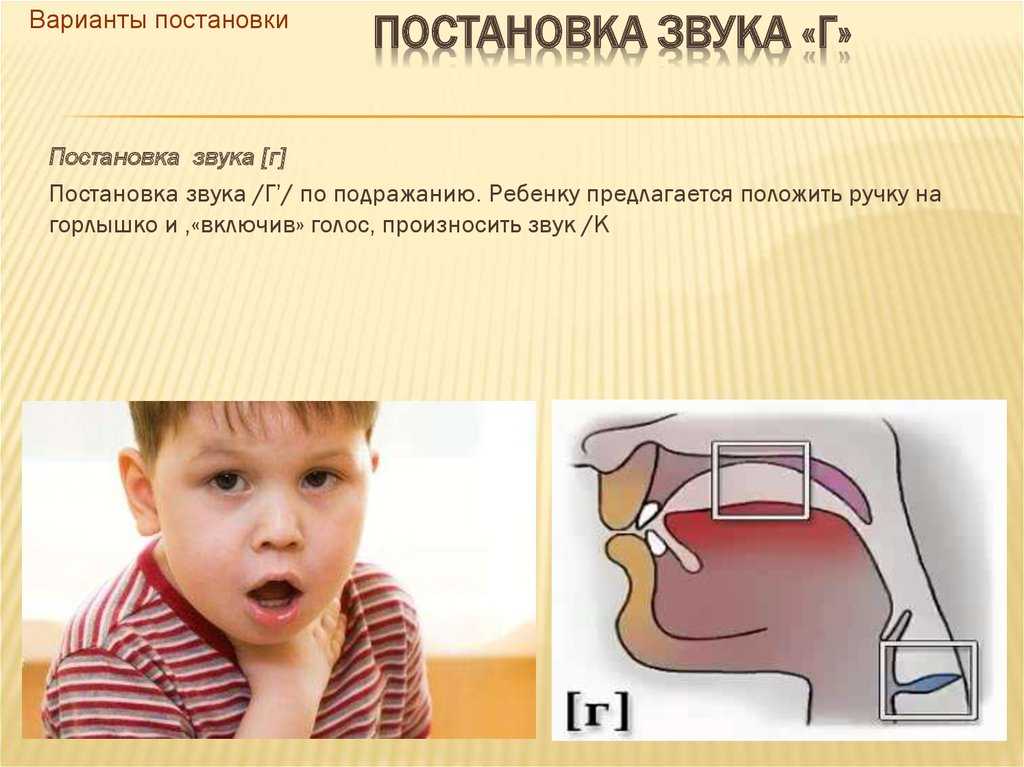 Постановка и автоматизация свистящих звуков: артикуляционная гимнастика, логопедические упражнения