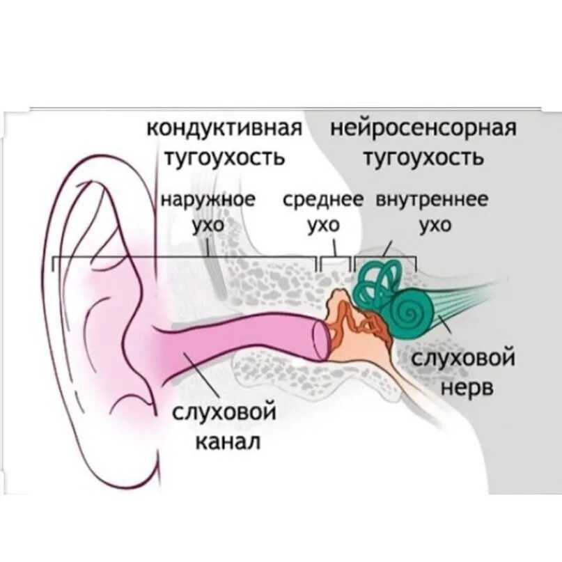 Нарушения слуха: формы, причины, проявления, тактика лечения у детей и взрослых
