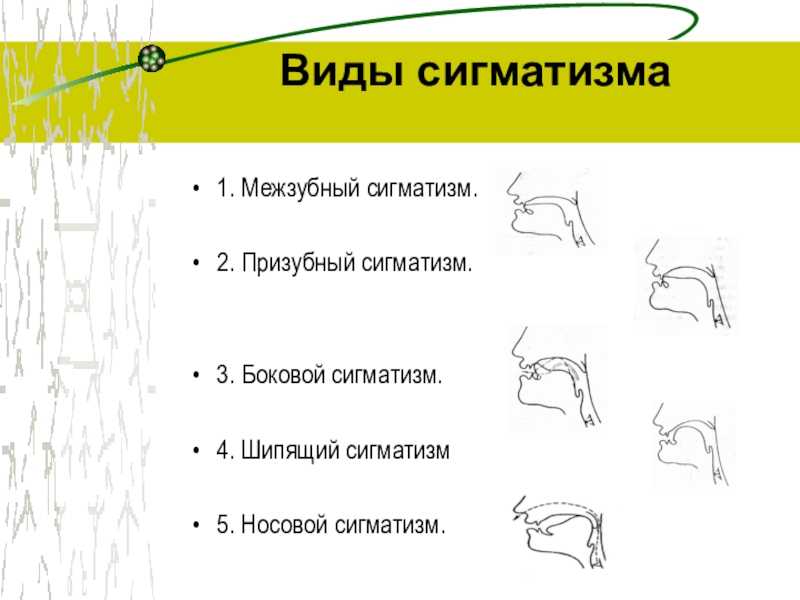 Дифференциация звуков [с-ш-ж-з-ц-ч-щ] - герасимова а. с - популярная логопедия. занятия с дошкольниками..doc