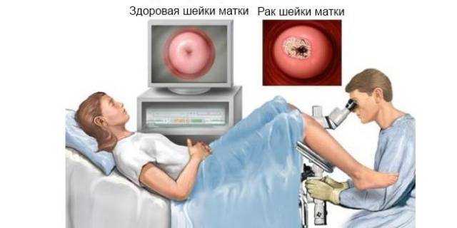 Мифы о беременности и родах