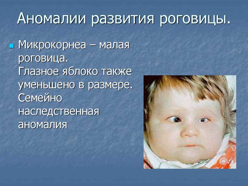 Врожденные заболевания