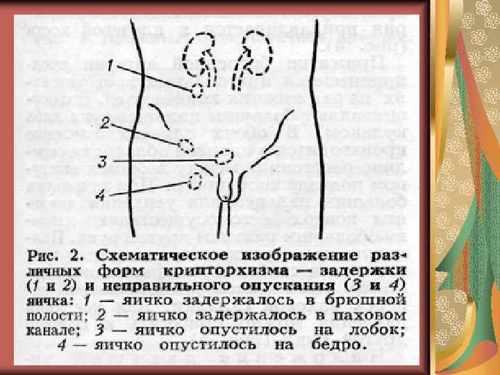 Эрекция у мальчиков (грудничка, подростка): во сколько начинается, как реагировать родителям