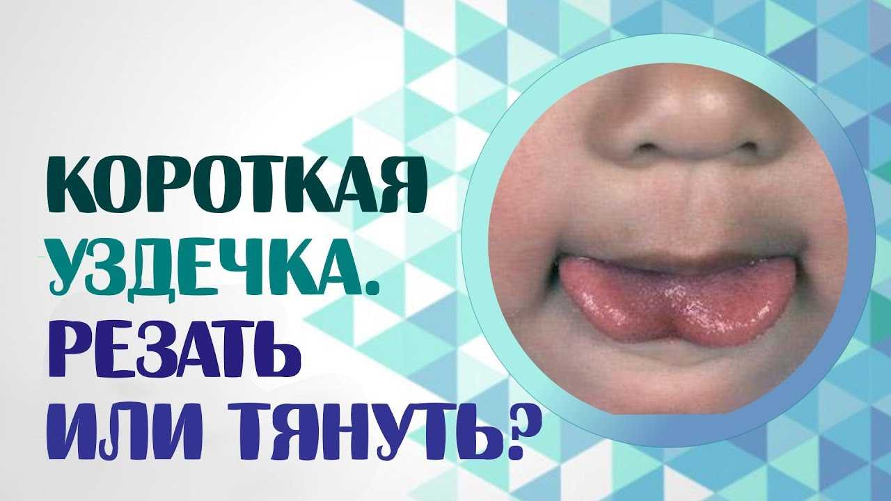 Картотека по логопедии на тему: комплекс упражнений для растягивания подъязычной связки