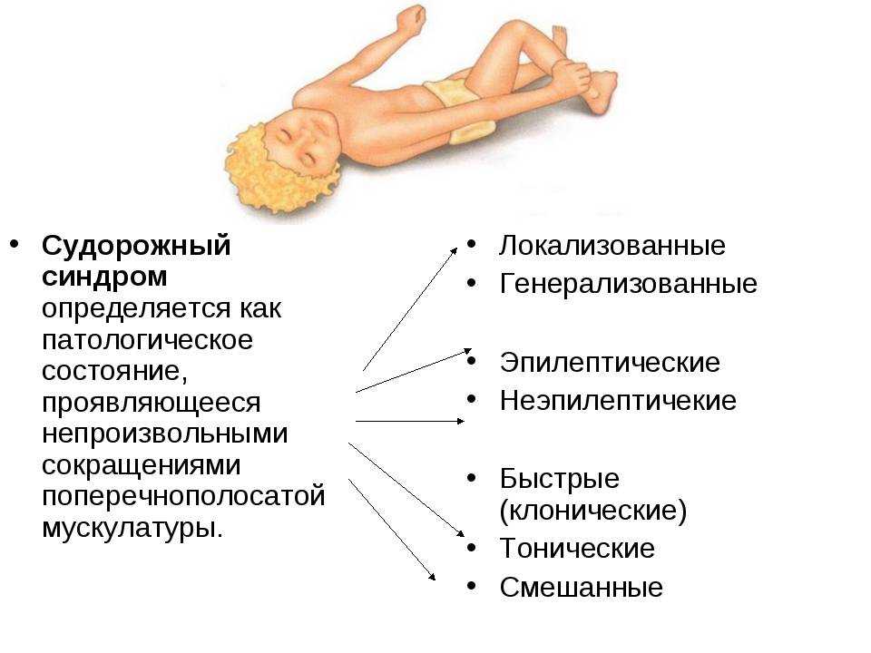 Как связаны аутизм и эпилепсия? | фонд выход, аутизм в россии