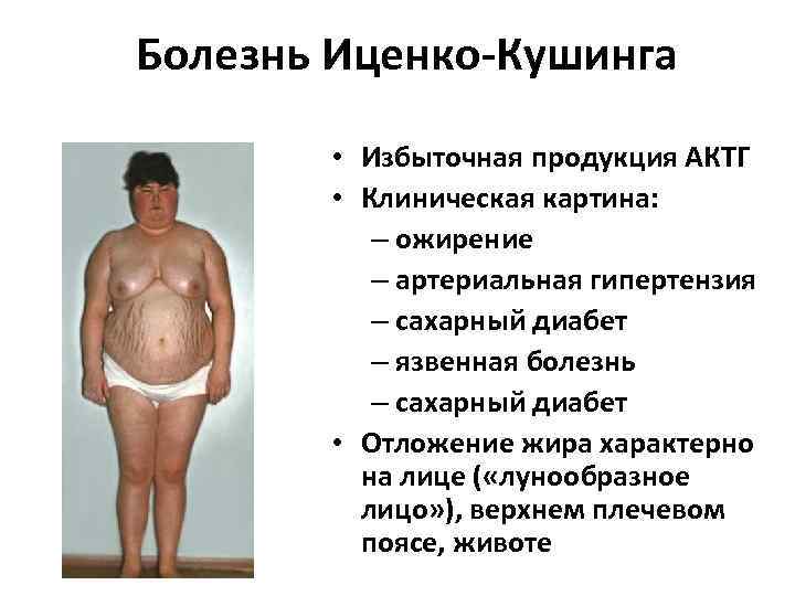 Гипердинамический синдром у детей - что это такое, лечение