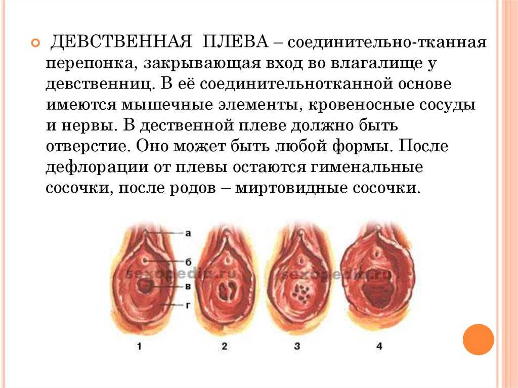 Почему меняется форма женской интимной зоны, и какой она должна быть. ответы на самые частые вопросы — центр эстетической медицины