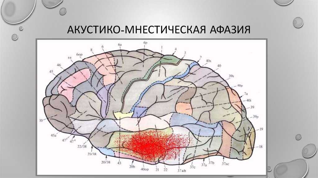 Акустико-гностическая афазия - дифференциальная диагностика