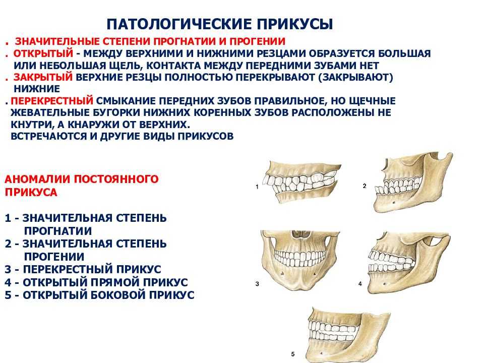 Исправление прикуса у взрослых: современные методы коррекции
